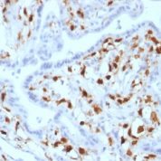 FFPE human placenta sections stained with 100 ul anti-Factor XIIIa (clone SPM180) at 1:50. HIER epitope retrieval prior to staining was performed in 10mM Citrate, pH 6.0.